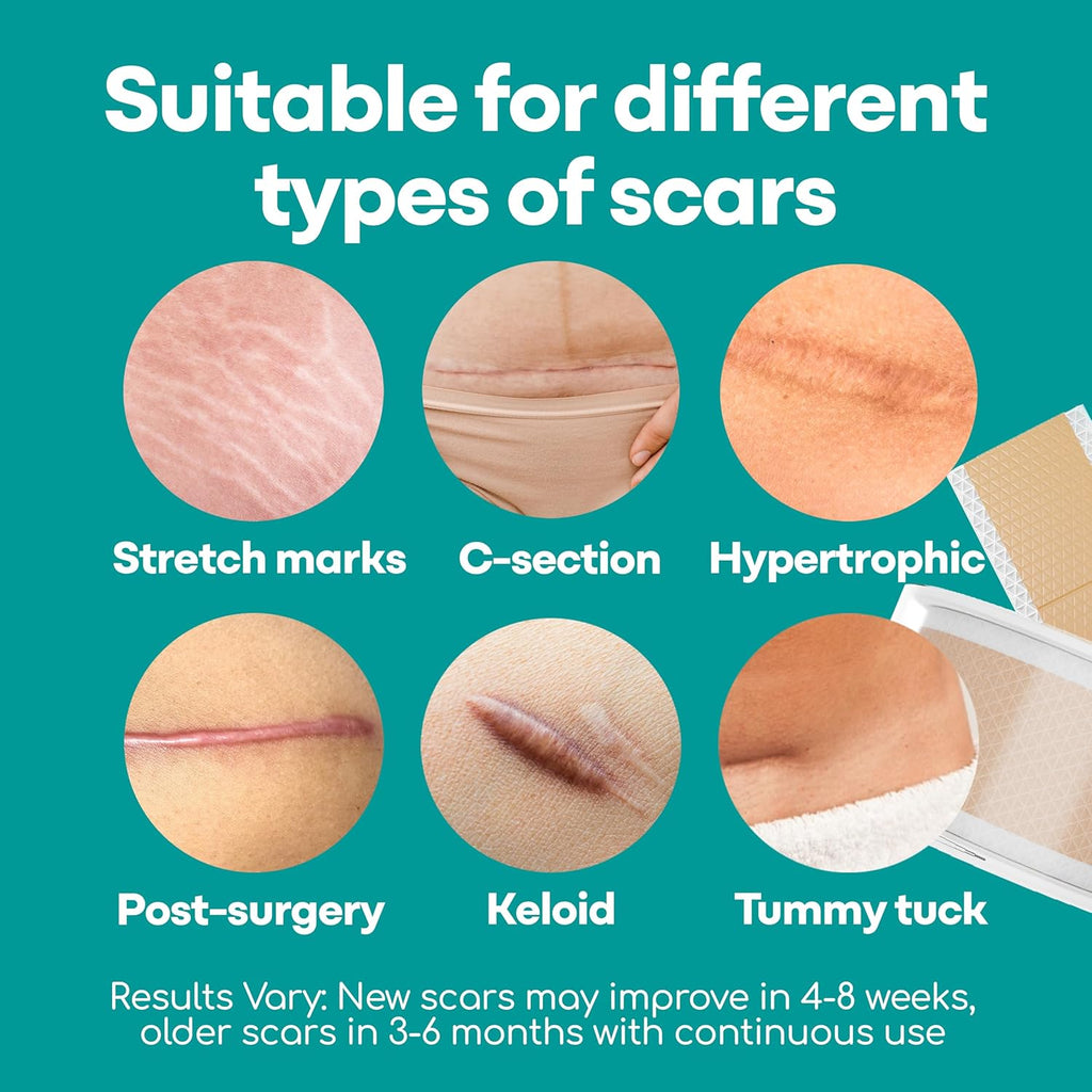 Silicone Scar Sheets, 80 Inches Long - Reusable Silicone Scar Tape - Includes Hygienic Storage Case S834
