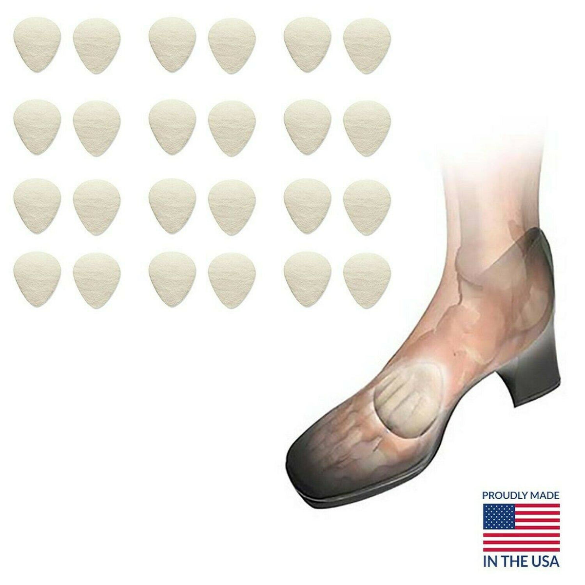 Metatarsal Cookies, 5/16 inch, Case of 12 Pairs F3974